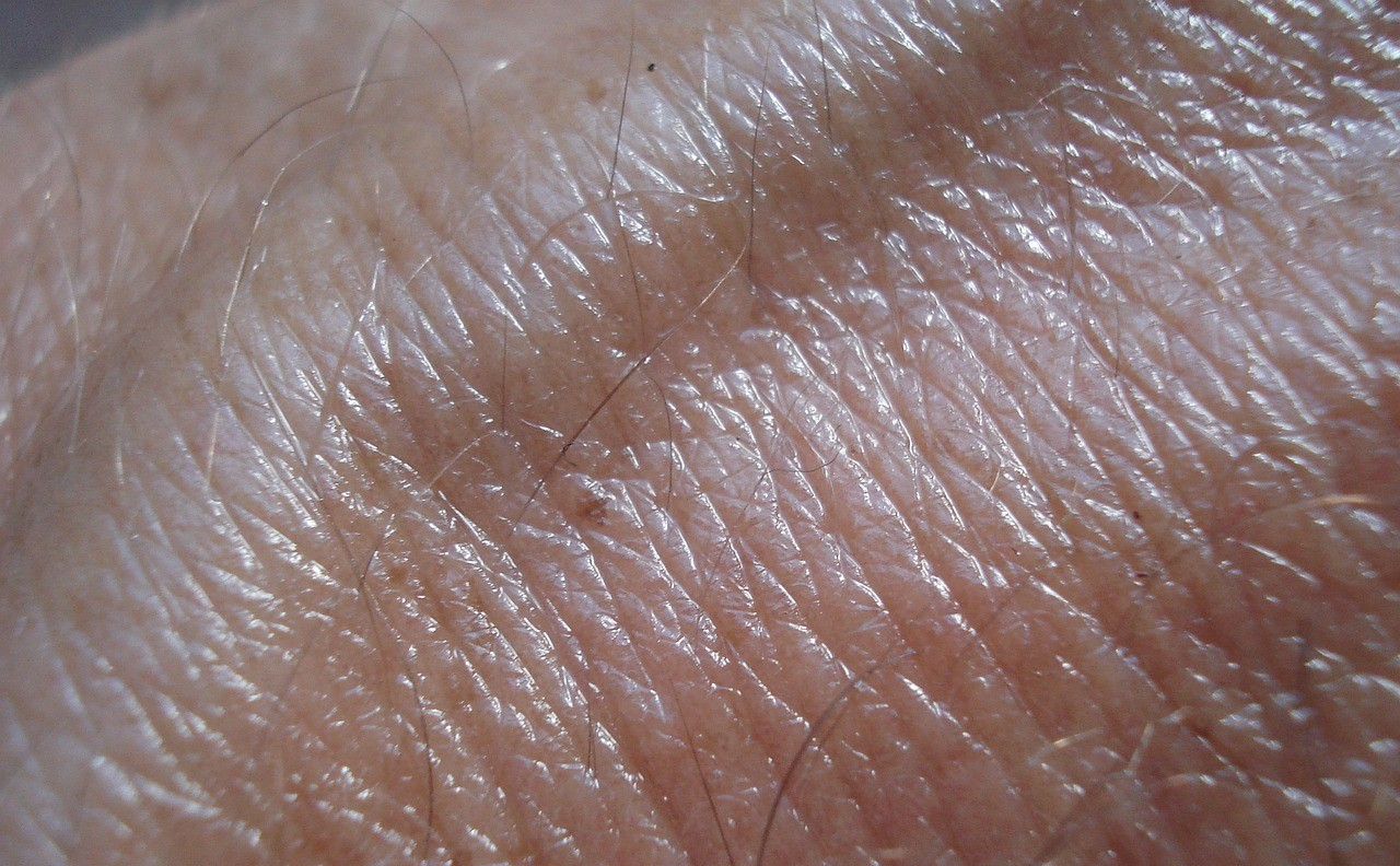 Comprehensive Guide to Identifying Skin Cancer Symptoms Early